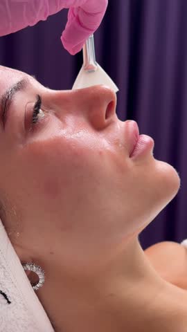 Chemical Peel Face Treatment with Retinol Serum.