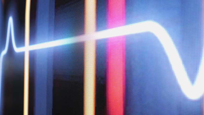 This image shows a closeup of an EKG waveform on a medical monitor, highlighting vital signs and health - Powered by Shutterstock - Get 15% off with code: PIKWIZARD15