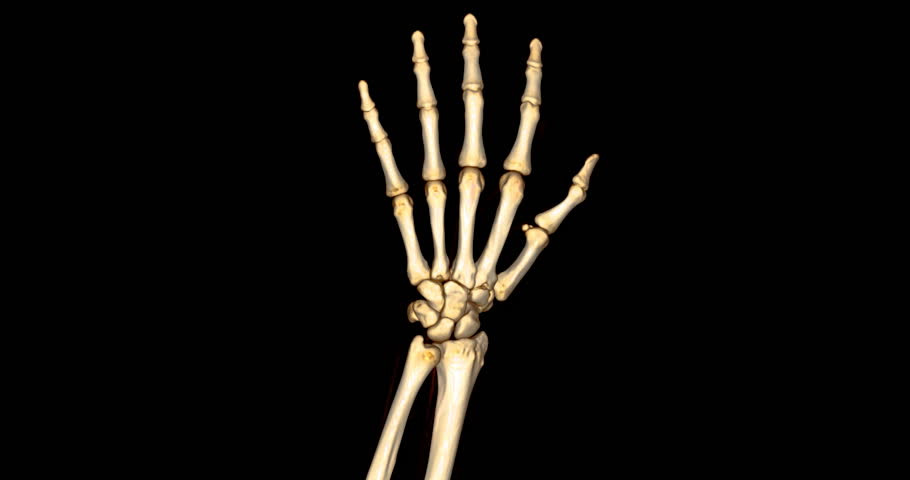 CT scan footage showing a detailed 3D rendering of a normal human hand. The scan highlights clear bone structures, joints, and soft tissues.