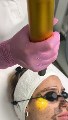 Beautician doing hardware carbon peeling to a young beautiful client in a headdress in goggles lying on a sofa in a beauty salon. Facial cleansing concept. Cosmetology services