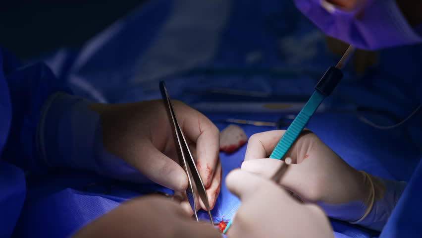 Two pairs of hands in latex gloves holding and applying surgical tools. Doctors perform operation. Close up. - Powered by Shutterstock - Get 15% off with code: PIKWIZARD15
