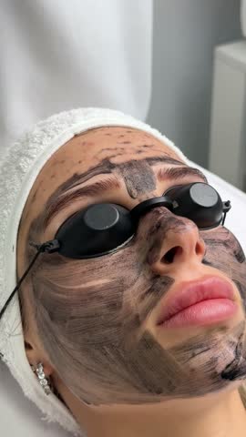 Close-up of cosmetologist's hand making hardware carbon peeling by young pretty customer woman in safety glasses headdress lying on couch in beauty salon. Facial cleaning concept. Cosmetology Services