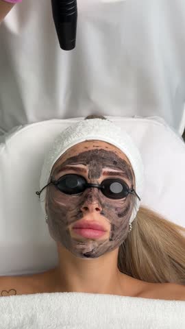 Close-up of cosmetologist's hand making hardware carbon peeling by young pretty customer woman in safety glasses headdress lying on couch in beauty salon. Facial cleaning concept. Cosmetology Services