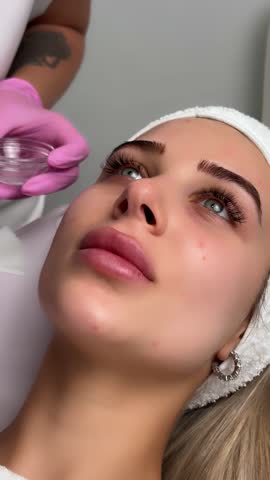 Chemical Peel Face Treatment with Retinol Serum.