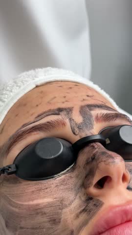 Beautician doing hardware carbon peeling to a young beautiful client in a headdress in goggles lying on a sofa in a beauty salon. Facial cleansing concept. Cosmetology services