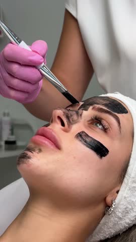 Close-up of cosmetologist's hand making hardware carbon peeling by young pretty customer woman in safety glasses headdress lying on couch in beauty salon. Facial cleaning concept. Cosmetology Services