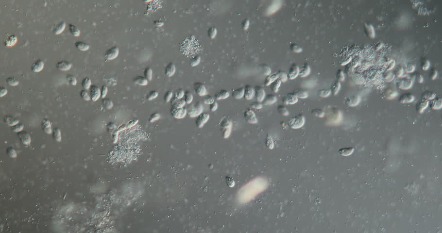 Ciliates and bacteria from wastewater move under the microscope at high magnification