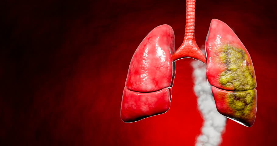 Medical artwork deadly impact of smoking, featuring a cigarette as the trachea and illustrating cancer-ridden, tar-stained lungs suffering from prolonged tobacco use and chronic diseases. 3D Rendering