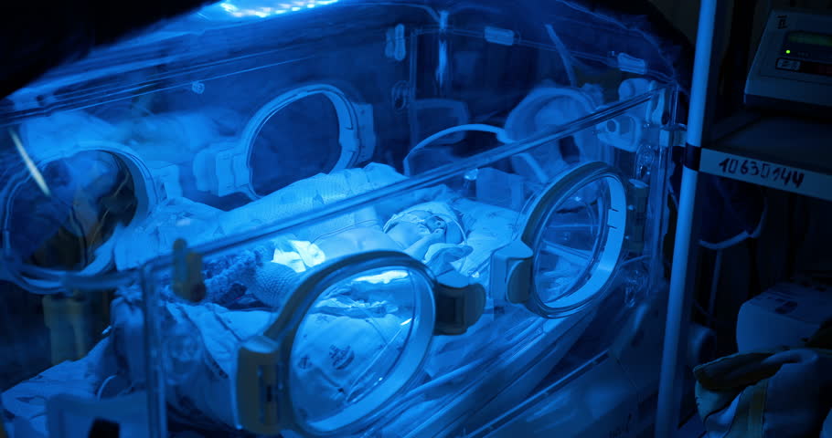 A newborn baby is placed in an incubator where it is receiving blue light therapy for the treatment of jaundice. A newborn is in the Neonatal ICU receiving crucial blue light therapy for health