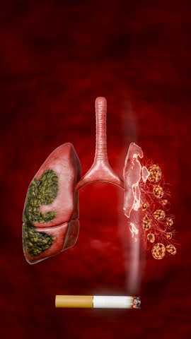 Smoking effects on lungs visualized, showing severe lung disease, tar deposits, cancerous growths, emphysema, and irreversible respiratory system damage due to prolonged cigarette use. 3D rendering