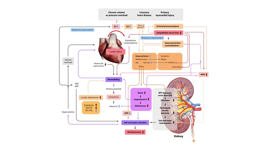 pathophysiology of heart failure, detailing mechanisms like volume overload, neurohormonal activation, remodeling, and organ perfusion changes, 3d 2d animation