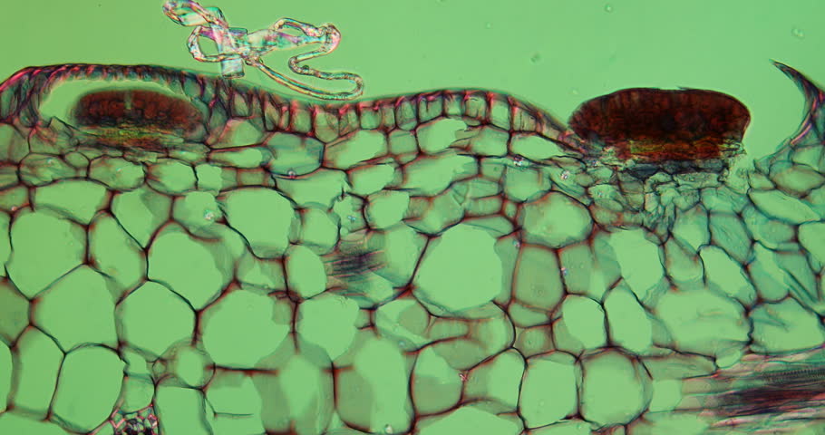 Urn leaf of the pitcher plant under the microscope 100x