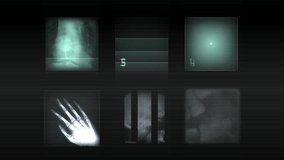 Detailed Medical XRay Human Bones Image Display. A collection of X-ray images showing bones and chest cavity in detail. Ideal for medical, healthcare, or educational purposes. - Powered by Shutterstock - Get 15% off with code: PIKWIZARD15