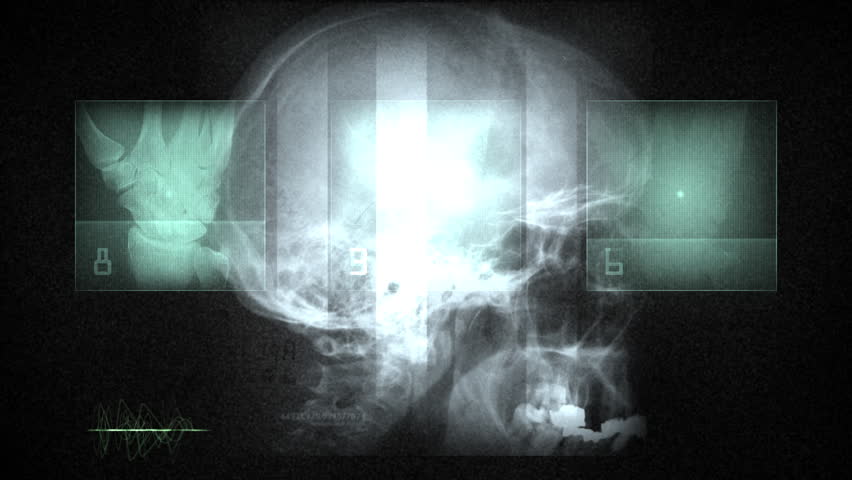 Medical X Ray Human Image Skull Digital Elements. Human skull X ray, featuring digital enhancements and bright light effects, conveying a futuristic medical concept.