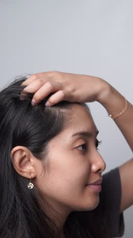 Close up footage of a young Asian woman pointing to the dandruff on her hair.