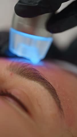 Close-up of hardware cleaning of facial skin in cosmetology. A cosmetologist performs a procedure for a patient, care for appearance and health. High quality 4k footage