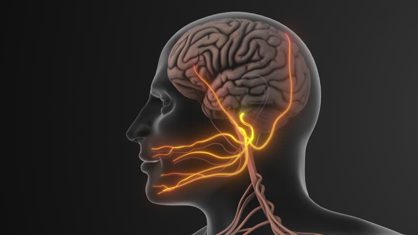 Facial Pain Triggered by Trigeminal Nerve Compression