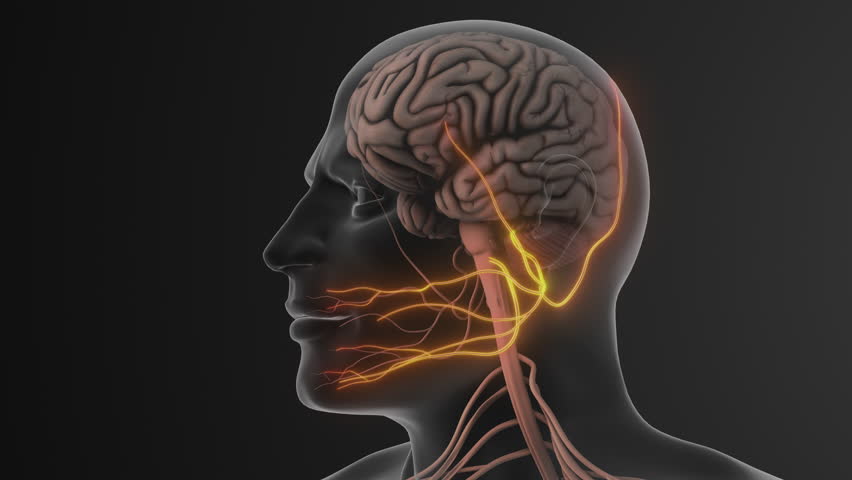 Facial Pain Triggered by Trigeminal Nerve Compression