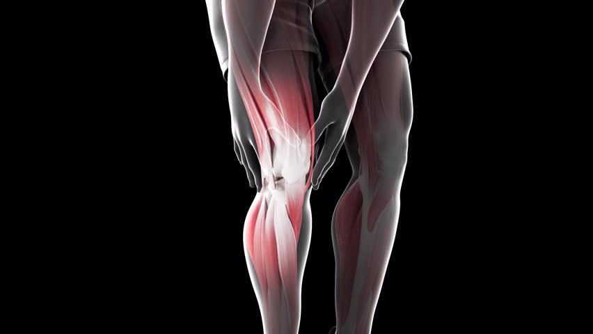 This 3d animation shows a man suffering from knee pain