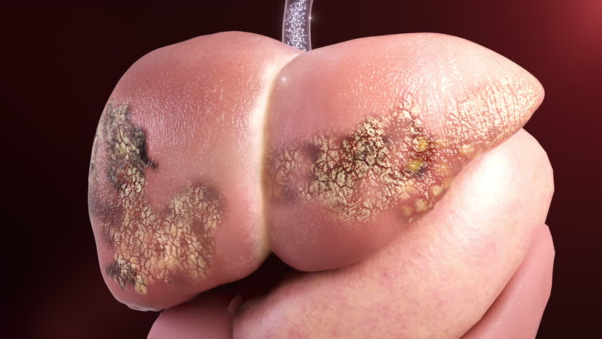 Drug molecules treat cirrhosis, hepatitis and liver damage,3d animation.