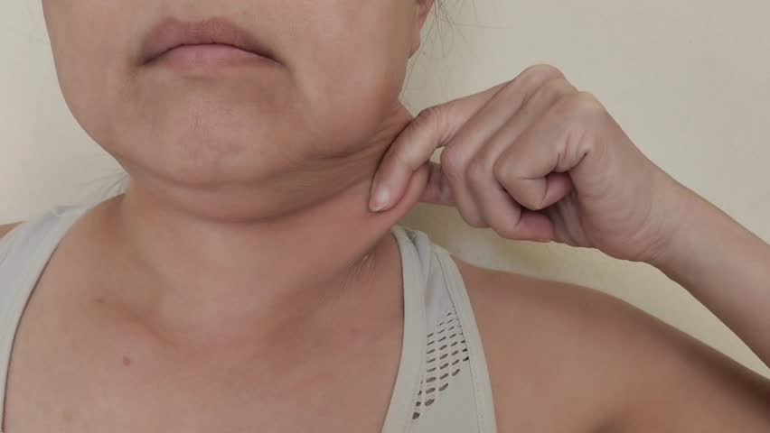 portrait the fingers holding the flabbiness adipose sagging skin under the chin, neck wattle and cellulite, scar and loose, dull skin and creases of the woman, health care and beauty concept.