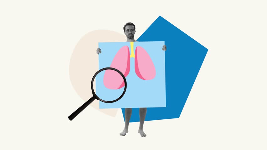 Stop motion. Animated clip. Man holding giant pictue of lungs, having fluorography of organs. Giving up smoking, following healthy lifestyle. Cocept of medicine, awareness, treatment