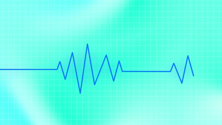 Background abstract wave Heartbeat lines animation background created with computer graphics. blue and green color wave and grid . healtcare footage 4k