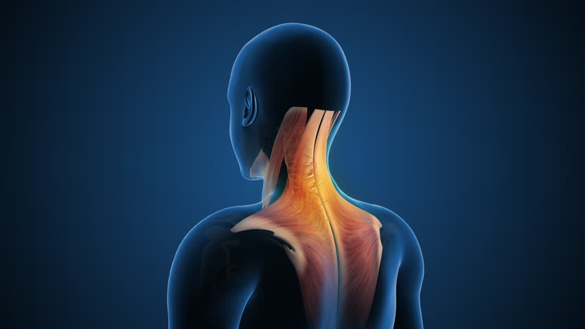 Neck Pain Associated with Cervical Posture Issues