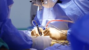 Unrecognized surgeon's hands in latex gloves apply electric tool at operation. Device in doctor's hands produces smoke. Neurosurgery in progress. - Powered by Shutterstock - Get 15% off with code: PIKWIZARD15