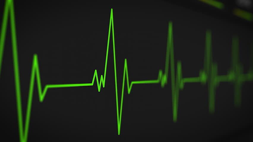 Vital Signs Monitor Screen Showing Heart or Pulse Rates. Green Chart with Medical Parameters on a Digital Display. Patient's Vitals in Healthcare Hospital. ECG Graph on Intensive Care Unit