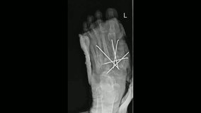 The Role of X-Rays in Modern Medicine: A Diagnostic Tool - Powered by Shutterstock - Get 15% off with code: PIKWIZARD15