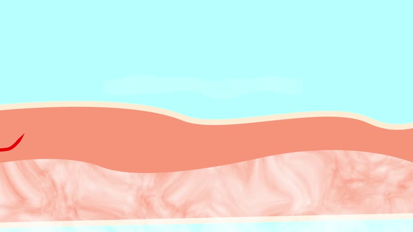 Closeup view of woman with varicose veins on white background. Illustrations of damaged and healthy vein, longitudinal section