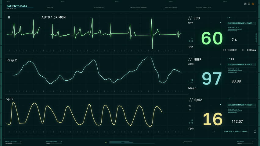 Machine is testing the vital life signs of the sick person. Medical machine used for testing of the vital health signs. Testing machine identifies the sudden drop in the vital health signs. Disease.