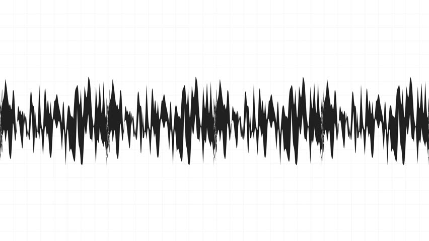 Heartbeat animation with a pulsing heart rate line on a green screen background, ideal for medical, health, and fitness-related projects, presentations, or video intros. 
Easily removed green screen. 