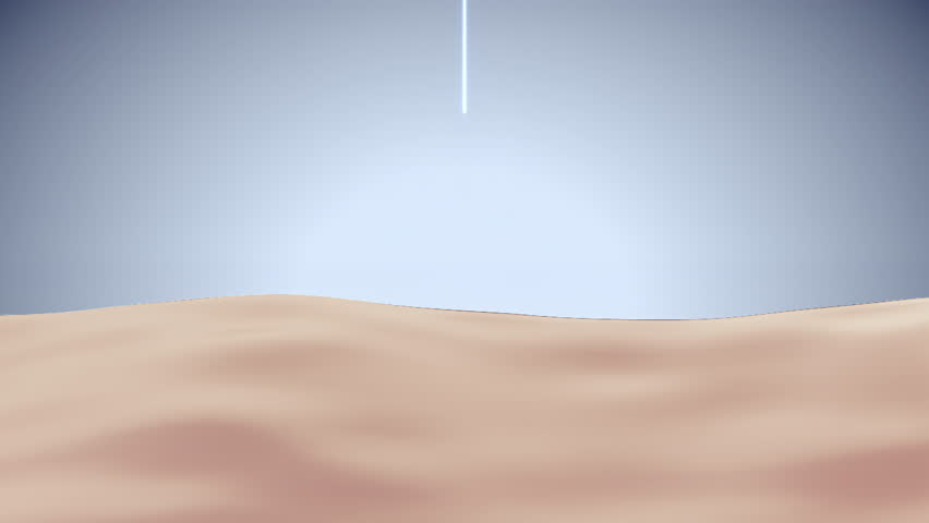 Laser shot through skin cell layer, skin and Facial treatment. 3D animation.