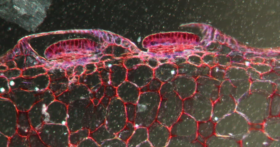 Pitcher plant, urn leaf with digestive glands in Darkfield tissue under the microscope 100x