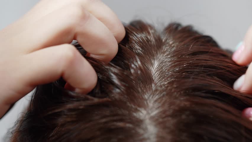 A woman scratching her scalp, feeling discomfort and irritation