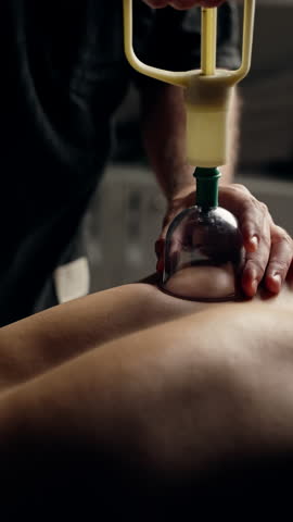 Professional masseur applying vacuum cupping treatment on patient back, performing alternative healing technique during therapeutic massage in medical environment