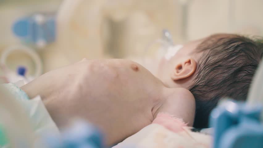 Closeup lovely little newborn baby infant lying in incubators for newborns, Newborn baby having the the breathing problem after birth, newborn in NICU, Neonatal intensive care unit.