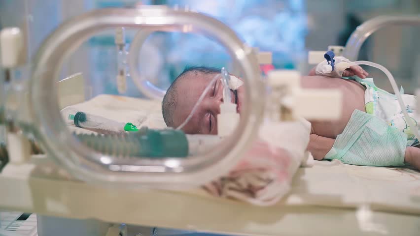 Closeup lovely little newborn baby infant lying in incubators for newborns, Newborn baby having the the breathing problem after birth, newborn in NICU, Neonatal intensive care unit.
