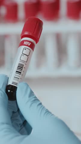 Healthcare professional carefully holds a blood test tube labeled HIV in a well-equipped clinical setting. This critical moment reflects the dedication to patient care and disease diagnosis.