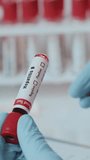 Healthcare professional skillfully hold a blood test tube marked Hepatitis B in a clinical laboratory, ready for analysis. - Powered by Shutterstock - Get 15% off with code: PIKWIZARD15