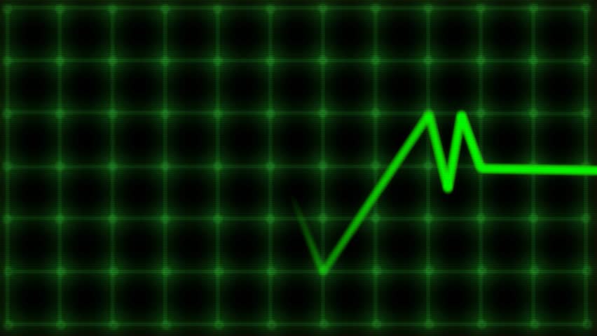 Heart Monitor With Pulse - Animated Representation