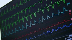 An Advanced Heart Monitor is Displaying Vital Cardiac Signals and Health Metrics to Users - Powered by Shutterstock - Get 15% off with code: PIKWIZARD15