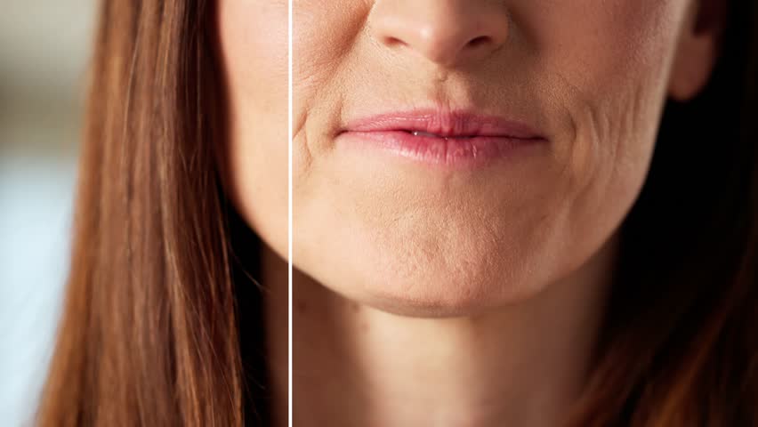 Close-up Of A Smiling Woman's Teeth Before And After Whitening