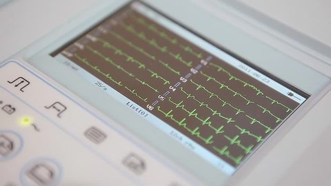 Cardiogram monitoring