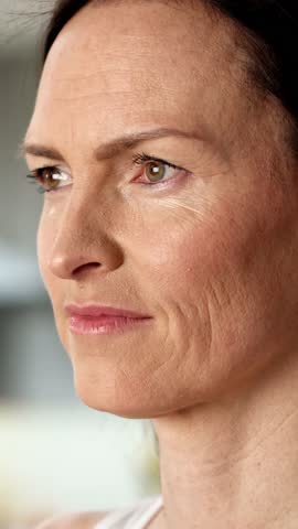 The Transformation Of A Young Woman's Skin: Before And After A Laser Facial Treatment For Wrinkles.