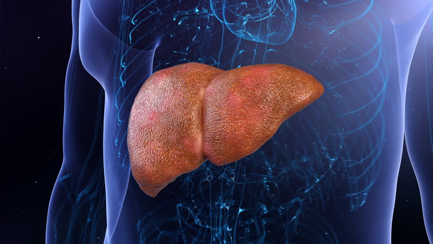 Digestive system cirrhosis, hepatitis, liver cirrhosis, malignancy, liver failure, fibrosis, cirrhosis, hepatocellular carcinoma, viral infection of the liver, 3d animation.