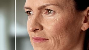 The Transformation Of A Young Woman's Skin: Before And After A Laser Facial Treatment For Wrinkles. - Powered by Shutterstock - Get 15% off with code: PIKWIZARD15