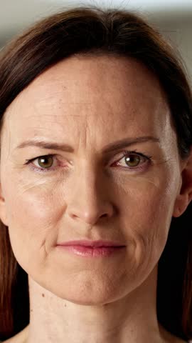 The Transformation Of A Young Woman's Skin: Before And After A Laser Facial Treatment For Wrinkles.